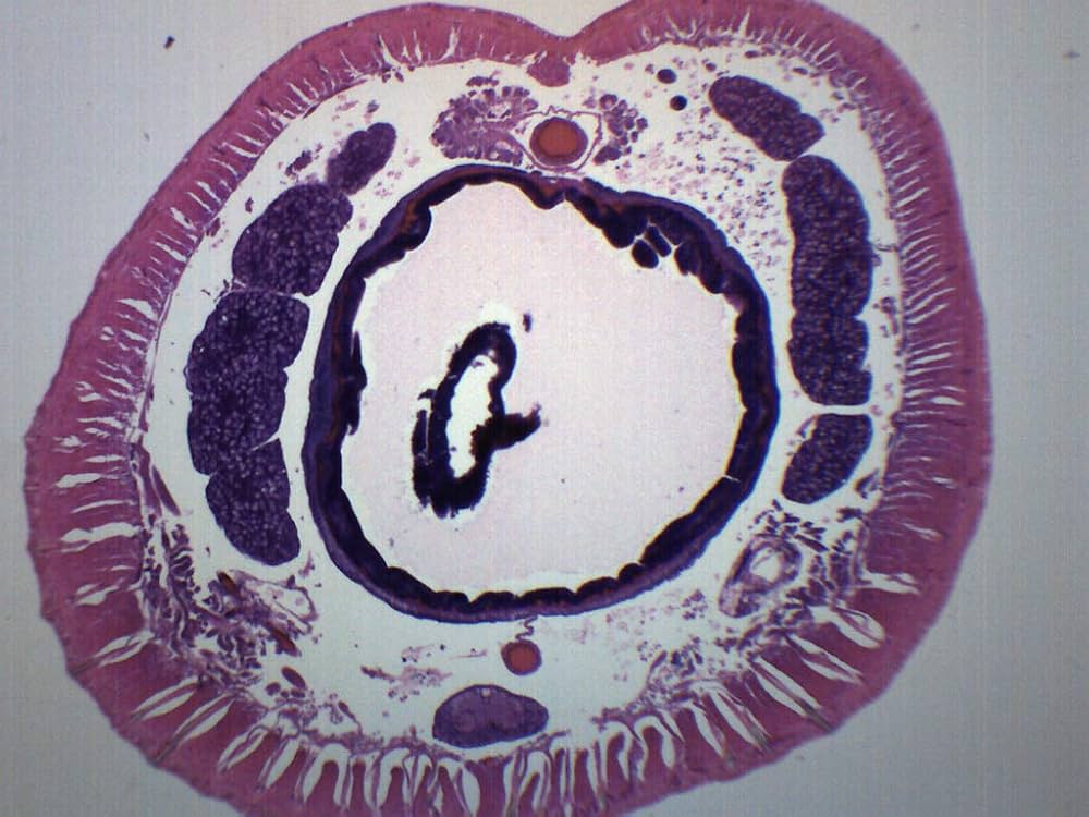 Amazon.com: EISCO Earthworm Setae, Cross Section - Prepared